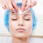 Peeling Químico Facial